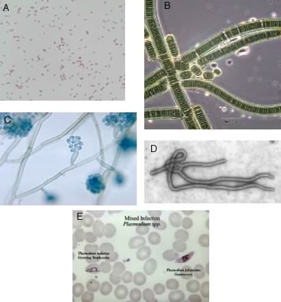 Some examples of the types of microbes present in the environment