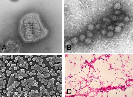 Some important pathogens