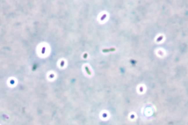 Capsule surrounding cells of Klebsiella planticola.