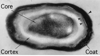 An endospore