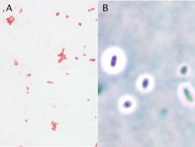 The simple stain and the capsule stain