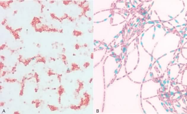 The endospore stain