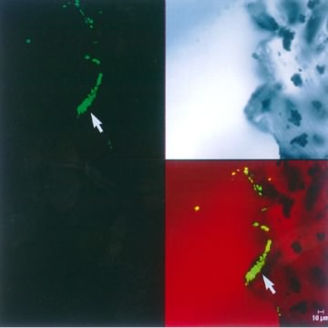 An image from a scanning confocal microscope